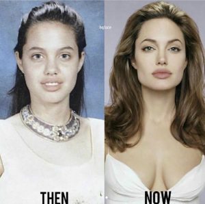 5 Razones para Mostrar Fotos de «Antes y Después» Claras y Consistentes en tu Negocio de Belleza